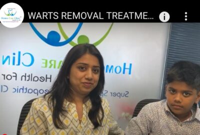 Homeopathy treatment for wart removal