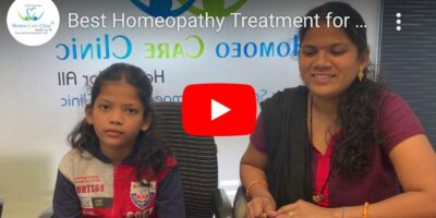 Homeopathy treatment for hair baldness (Alopecia Areata)