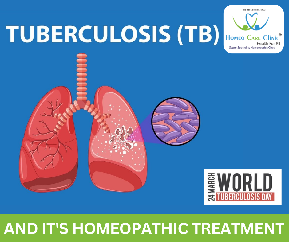 Natural remedies for tuberculosis treatment.