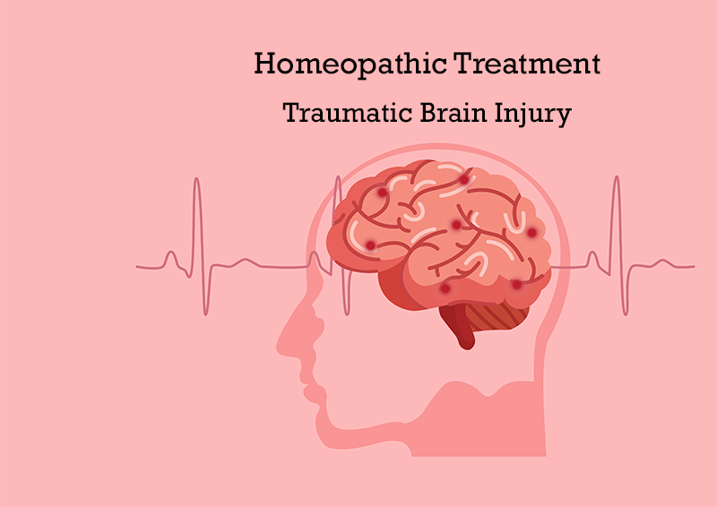 Homeopathic Treatment For Traumatic Brain Injury
