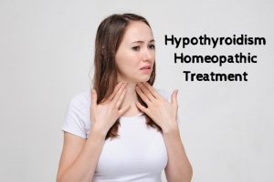 Hypothyroidism Homeopathic Treatment