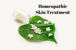 Homeopathy Vs Allopathy for Skin Treatment