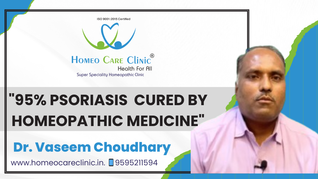 Psoriasis homeopathy treatment