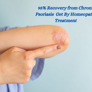 Chronic Psoriasis Get By Homeopathy Treatment