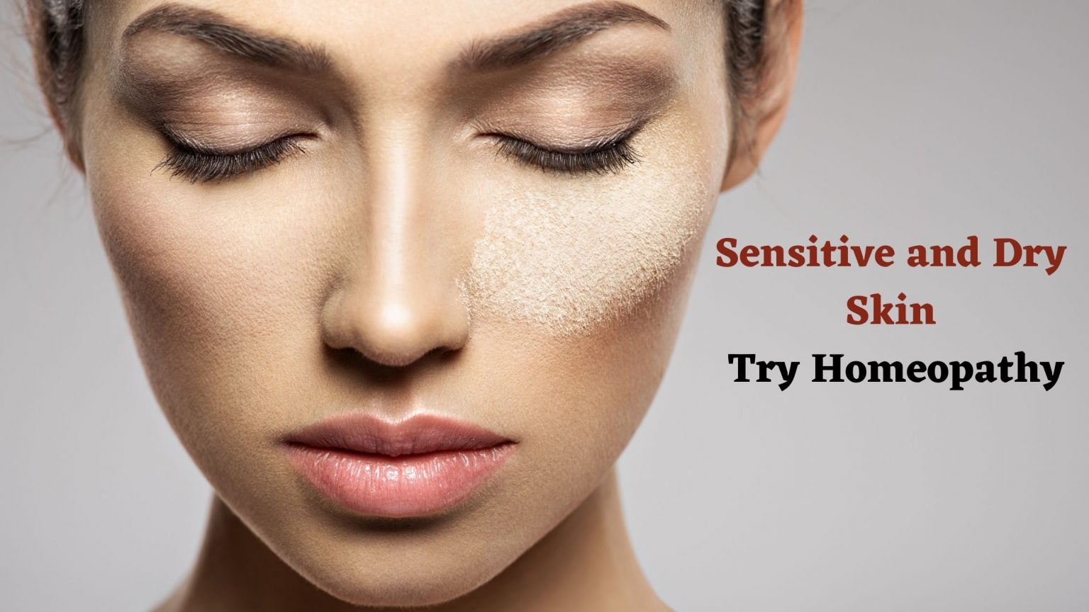 Sensitive and Dry Skin Try Homeopathy