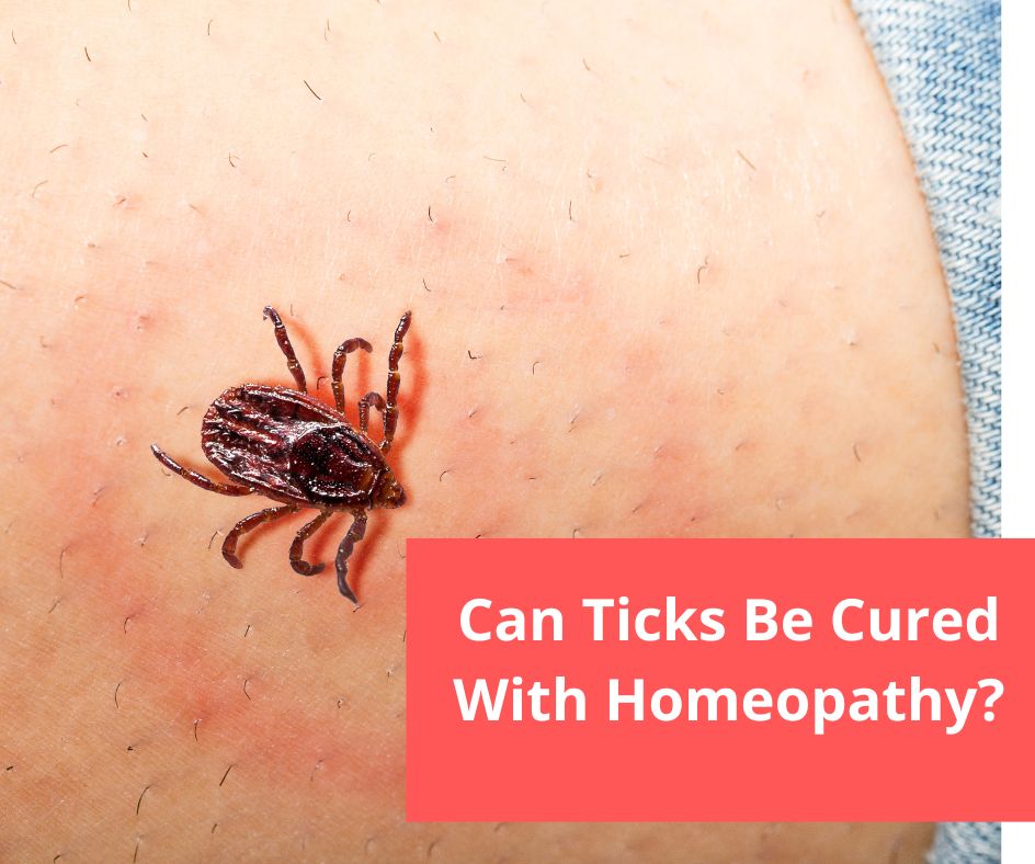 Can Ticks bite Be Cured With Homeopathy?