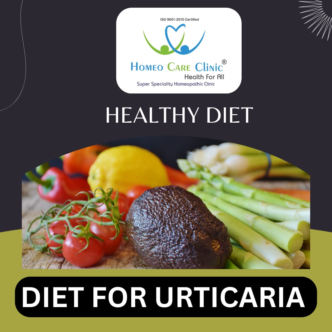 Diet For Urticaria