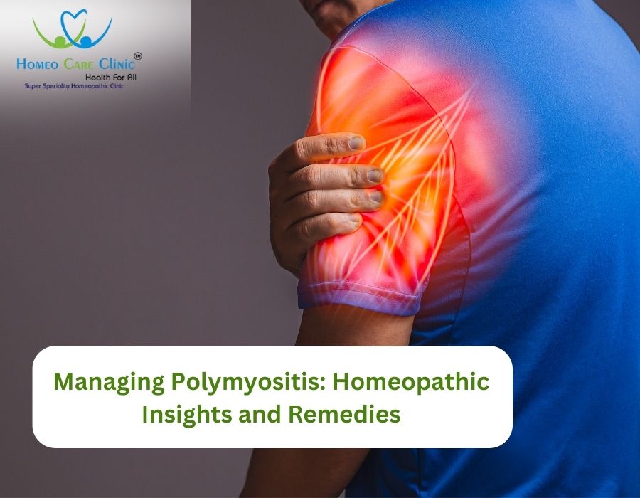 Managing Polymyositis Homeopathic