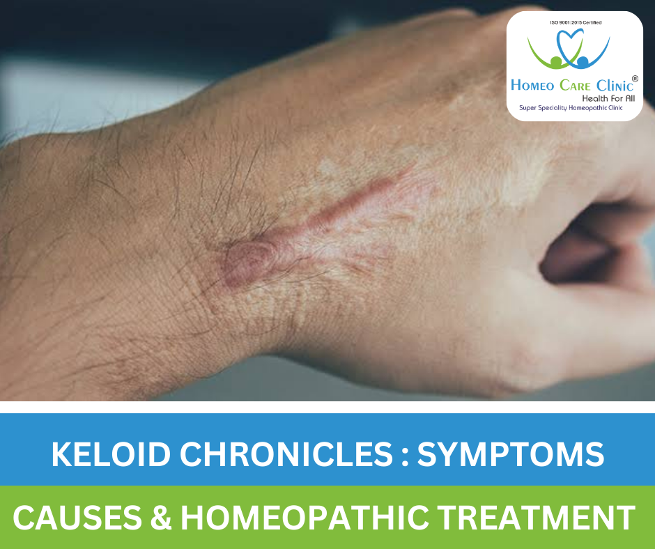 Keloid scar with homeopathic remedies