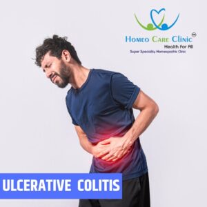 Ulcerative Colitis