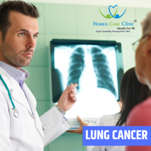 Lung Cancer Support | Homeopathic Treatment and Care - Homeo Care Clinic