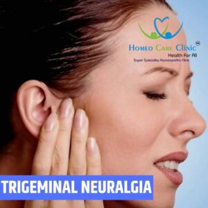 Trigeminal Neuralgia