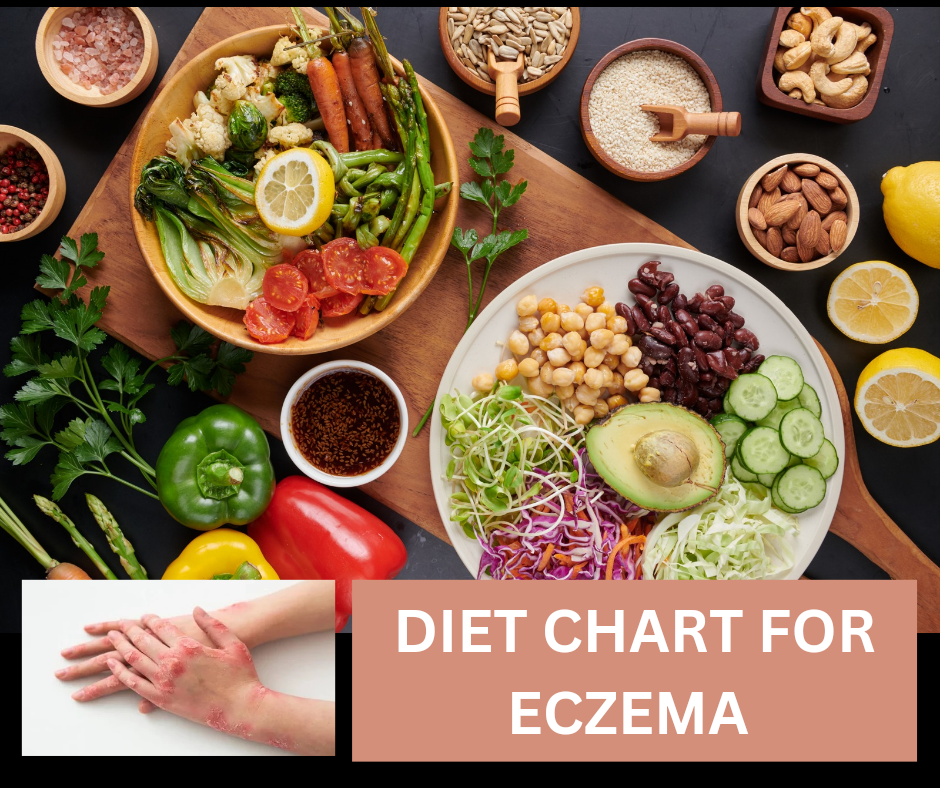 Diet Chart For Eczema