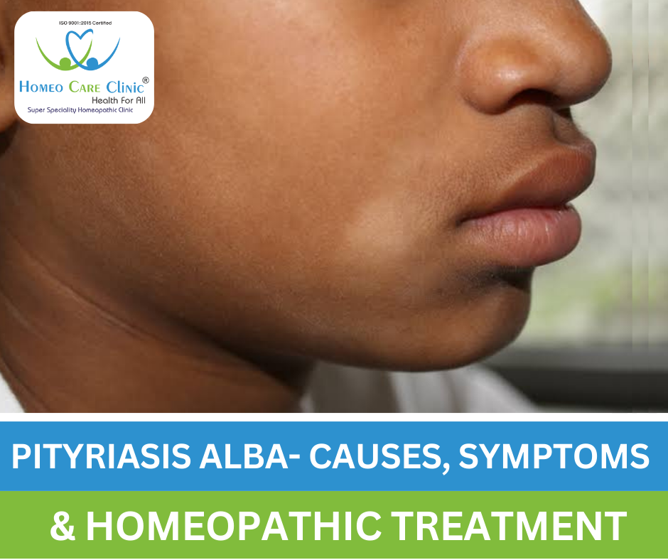 Pityriasis Alba Homeopathy Treatment