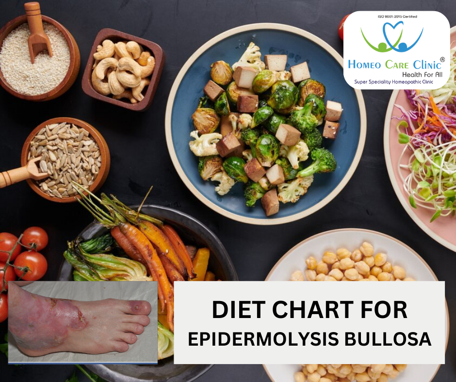 Diet chart for Epidermolysis Bullosa