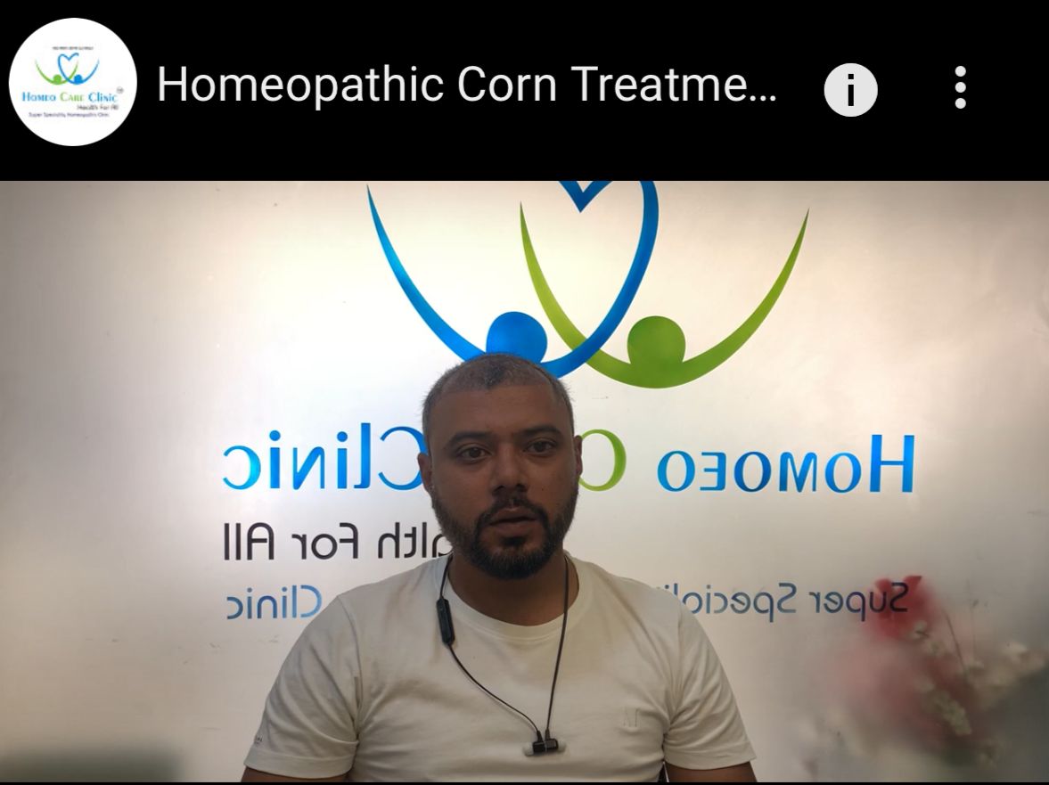 Foot Corn Homeopathy Cure