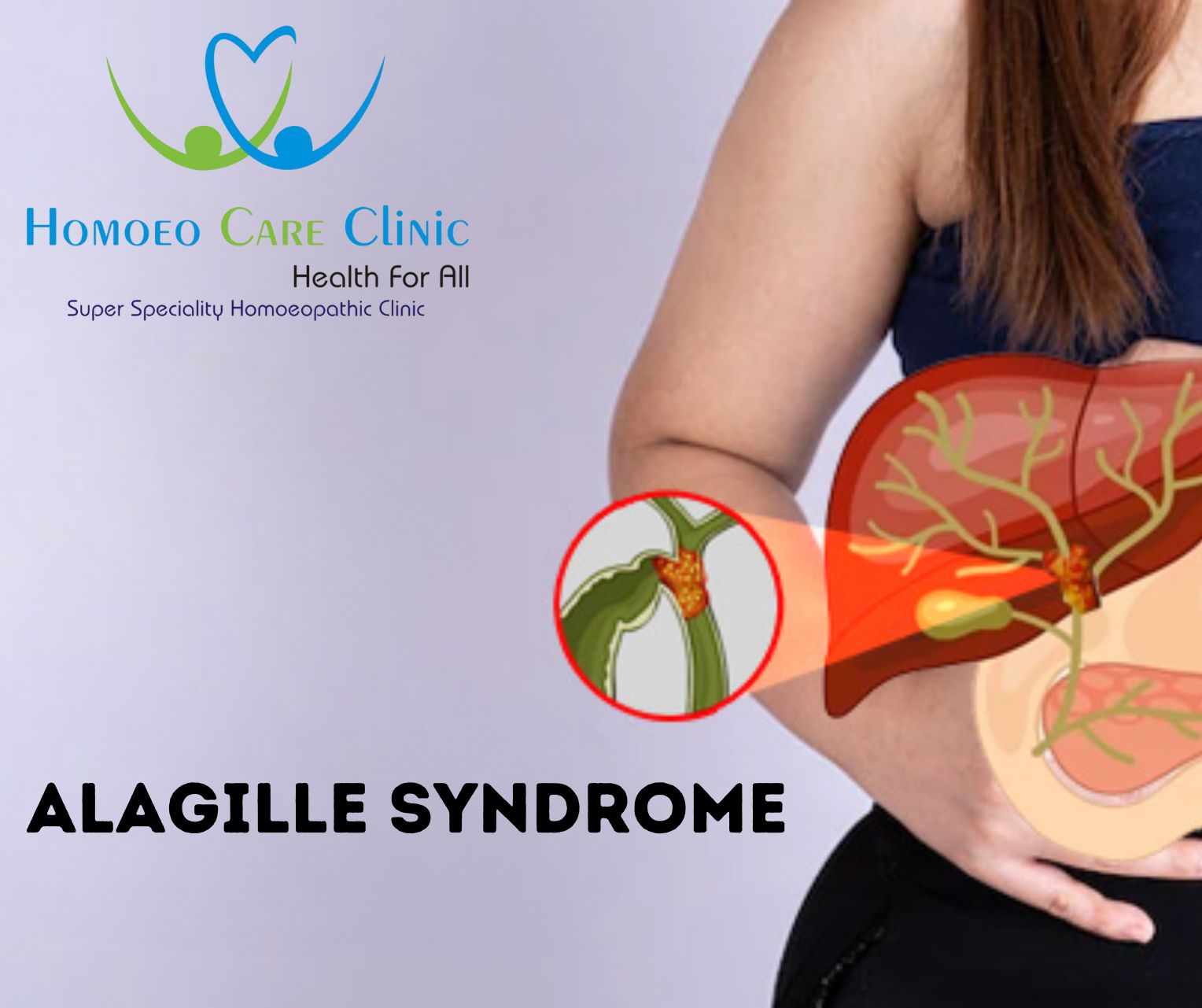 Alagille syndrome homeopathy