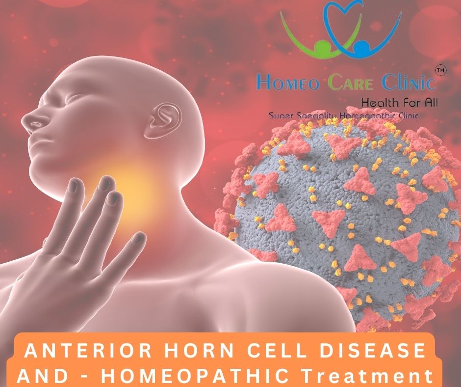 Anterior horn Cell Disease