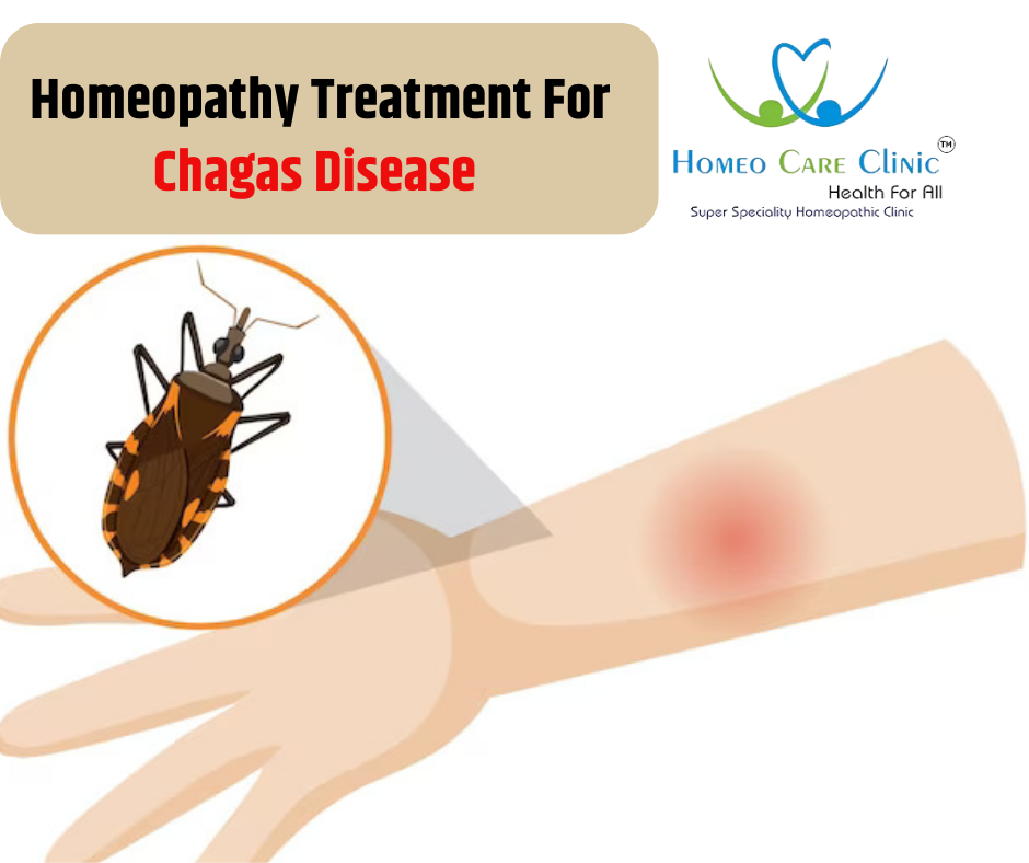 Chagas Disease homeopathey treatment