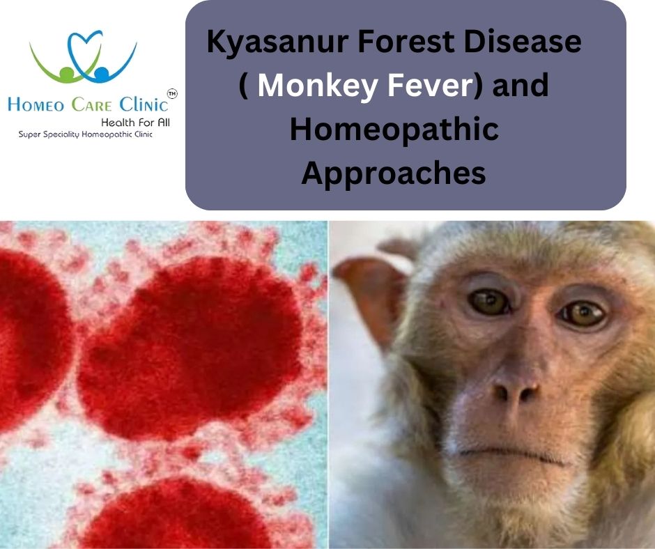 Monkey Fever homeopathy treatment