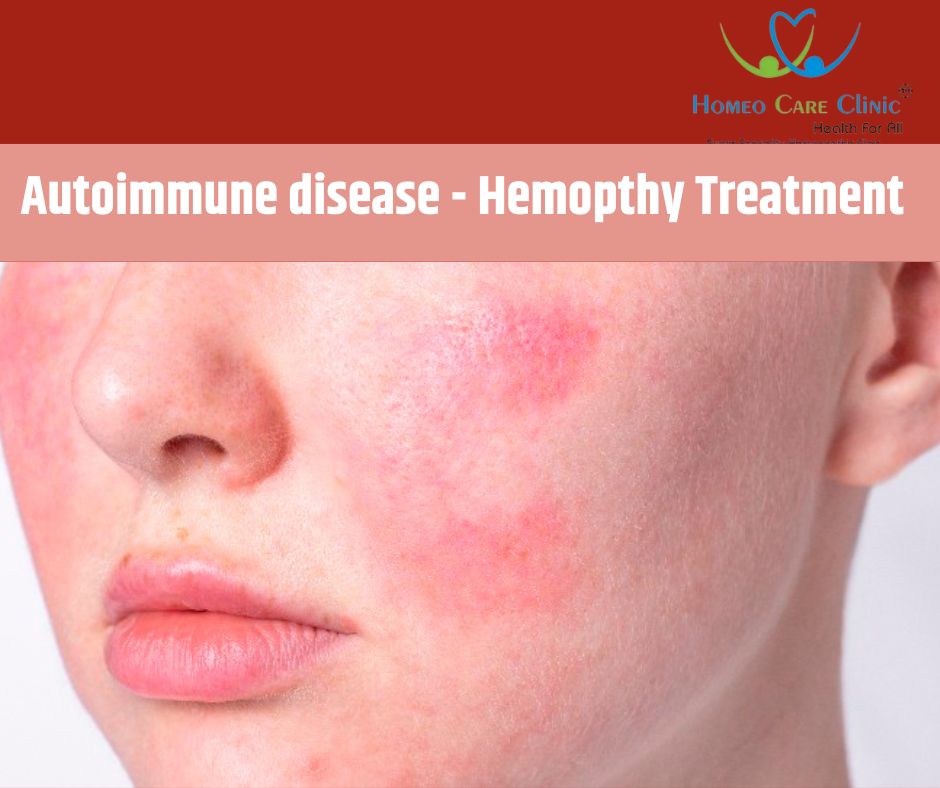 autoimmune disease treatment