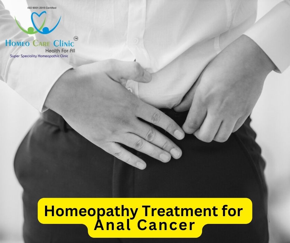 Treatment for Anal Cancer