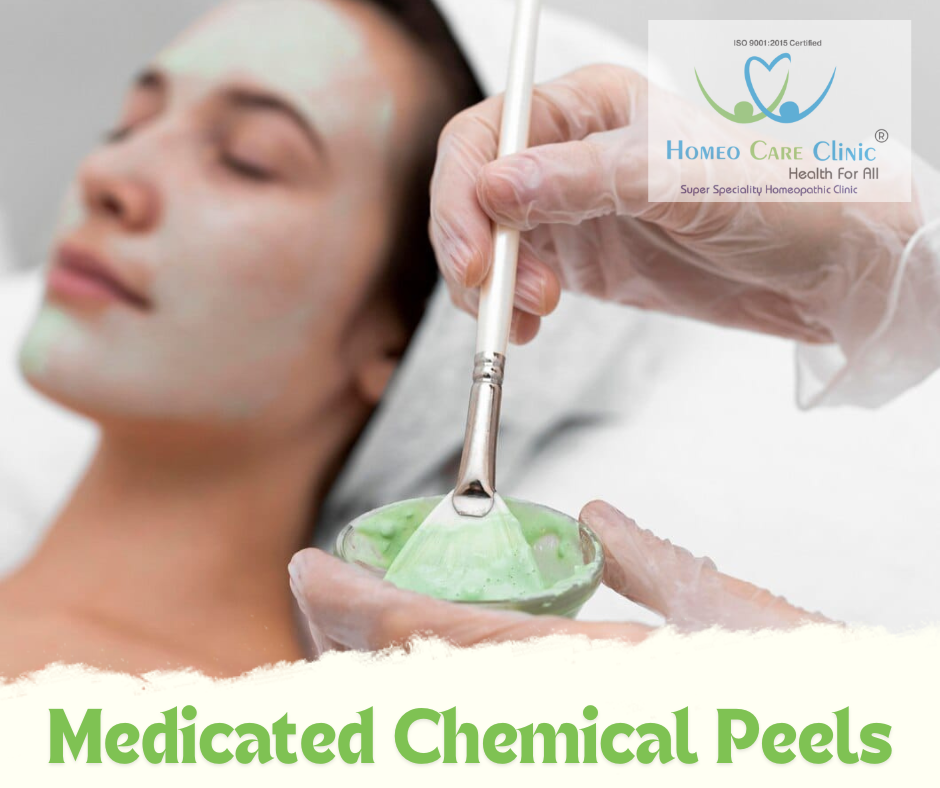 Chemical Peels