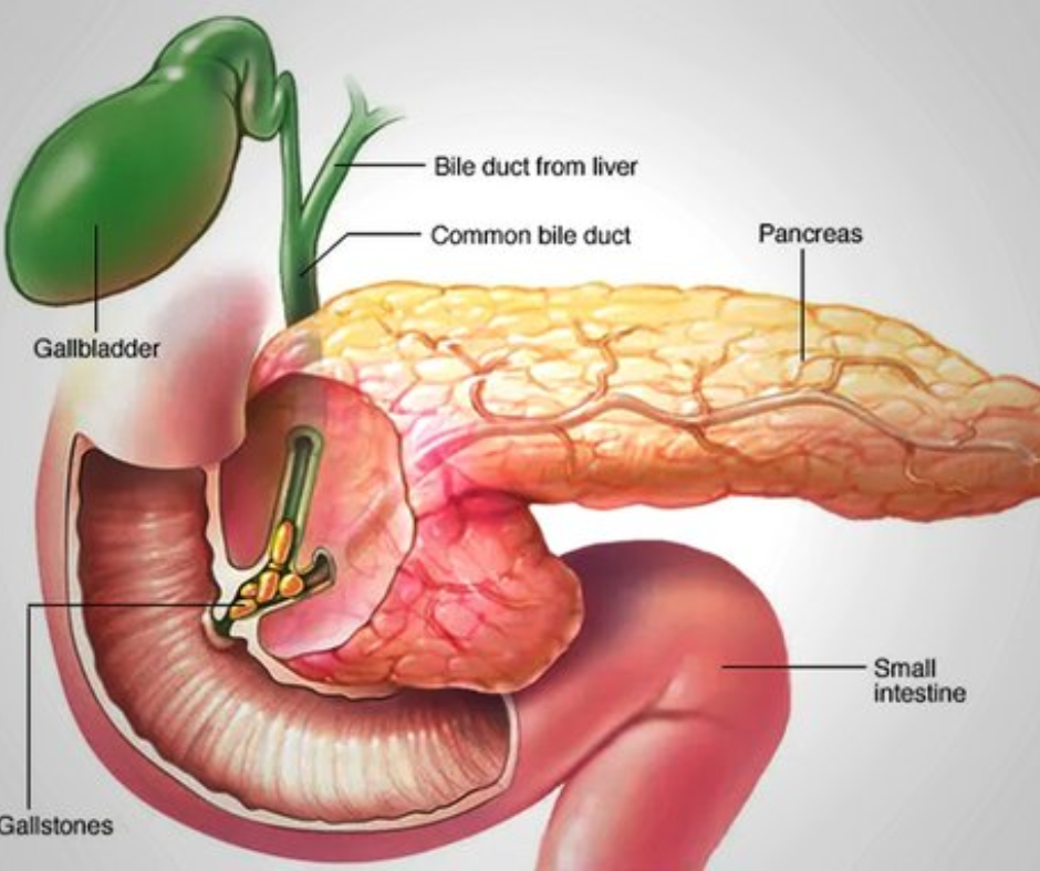 Diet Chart For Pancreatitis