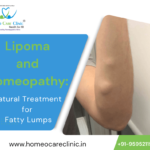 lipoma treatment in homeopathy