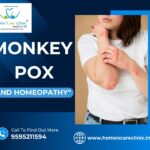 monkeypox symptoms and its homeopathic Treatments