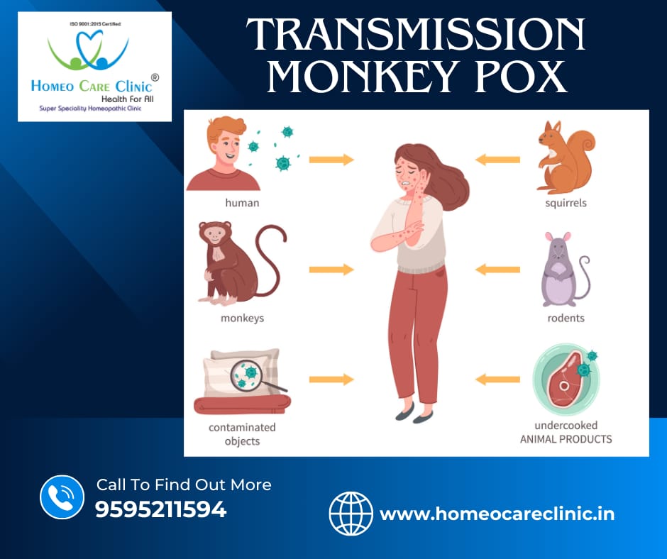 monkeypox transmisssion