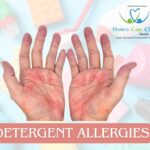 Detergent allergy skin reaction