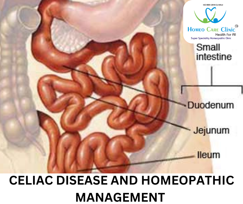 Celiac Disease and Homeopathic Treatment