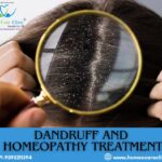 Dandruff: Types, Causes, Symptoms