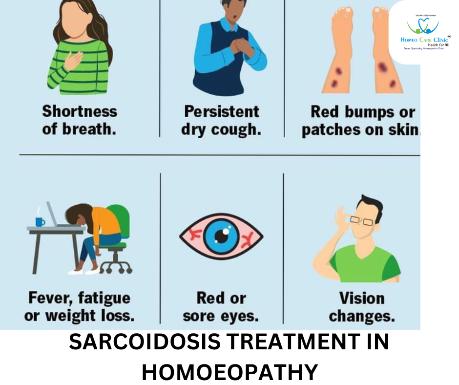 sarcoidosis stages