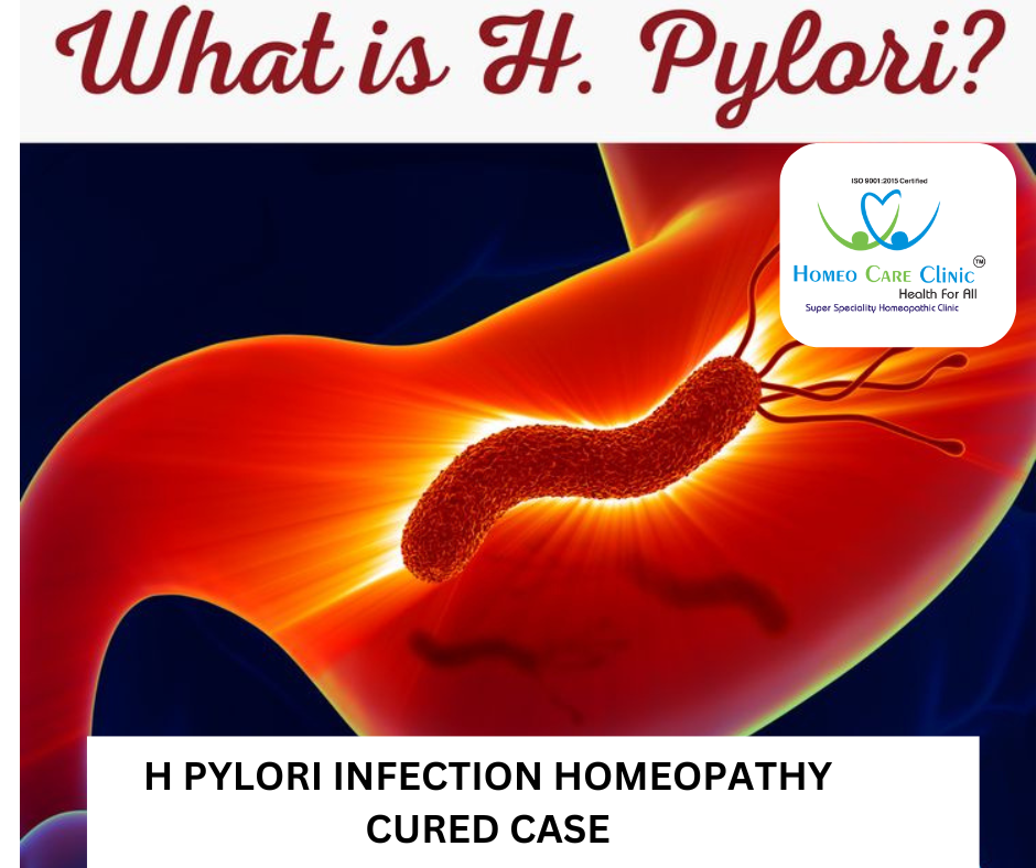 h pylori homeopathic remedies