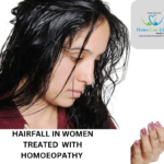 Homeopathic Treatment for Hairfall