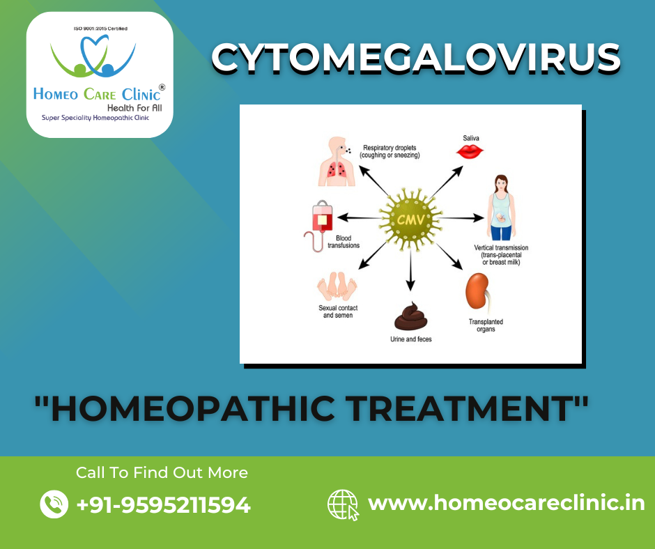 Homeopathy Treatment for Cytomegalovirus (CMV)