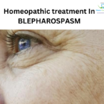 Homeopathic Remedies for Blepharospasm