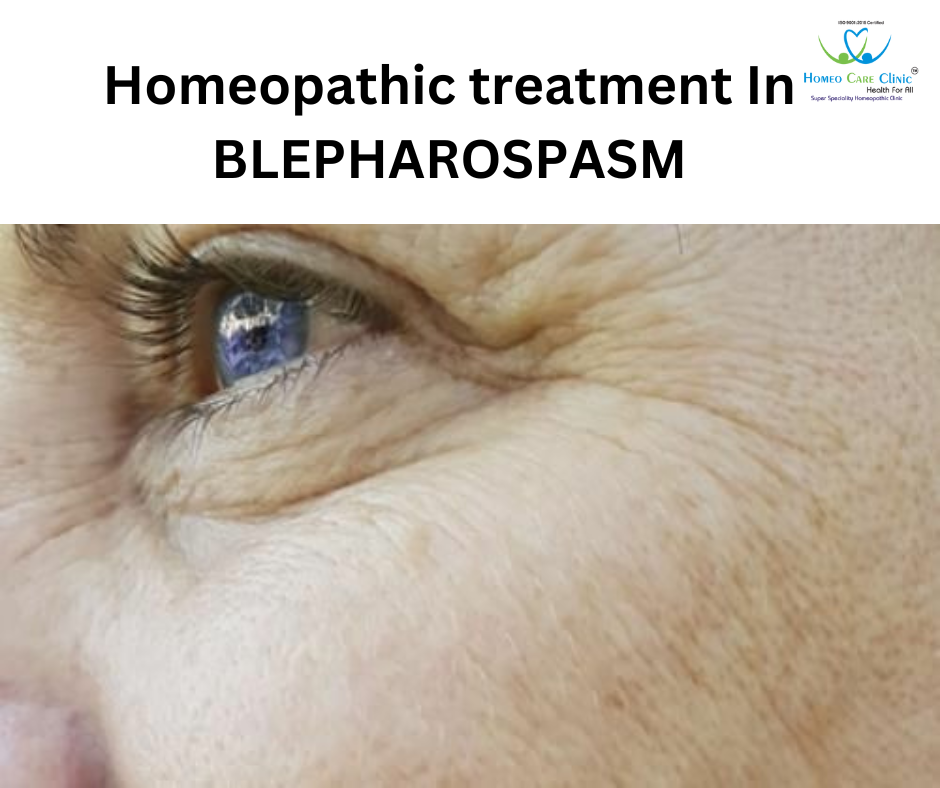 Homeopathic Remedies for Blepharospasm