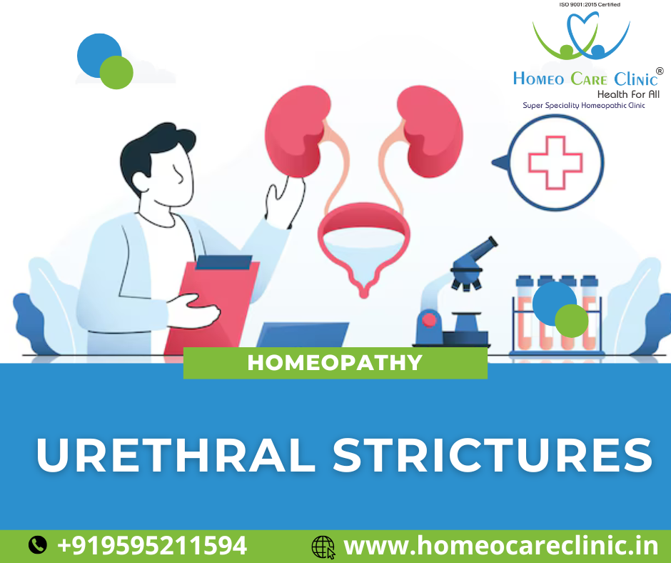 Homeopathic Treatment for Urethral Stricture