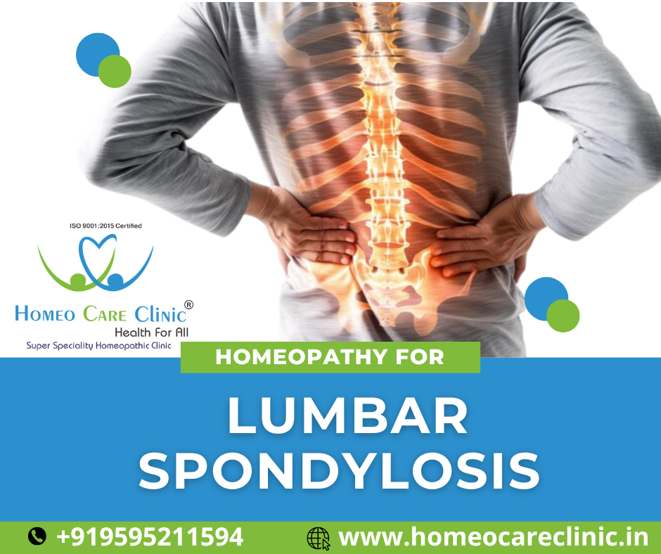 Lumbar Spondylosis Treatment in Homeopathy