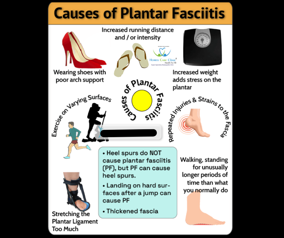 causes plantar fasciitis