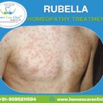 Rubella Homeopathic Treatment