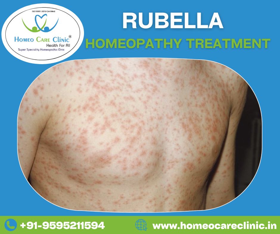 Rubella Homeopathic Treatment