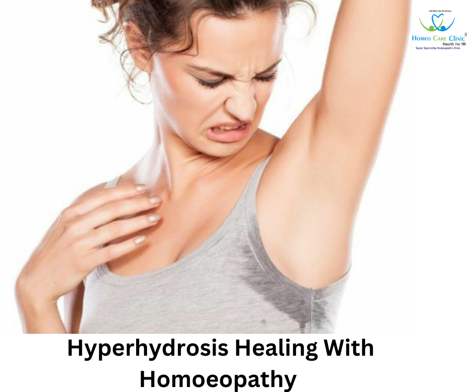 Homeopathic Treatment for Hyperhidrosis