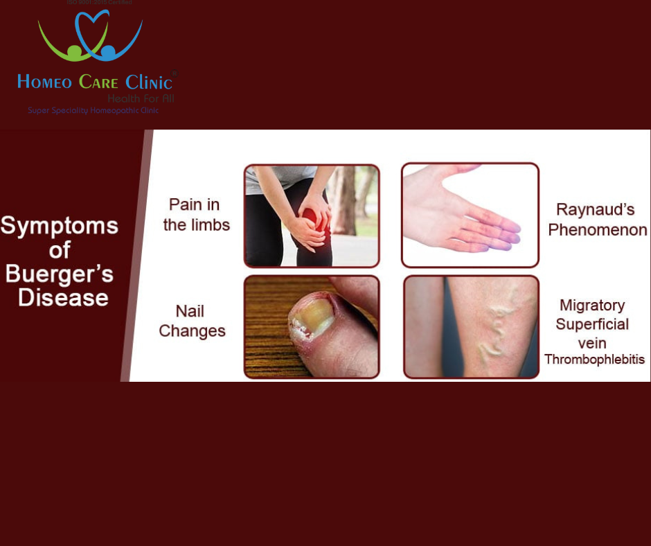 Buerger's Symptoms