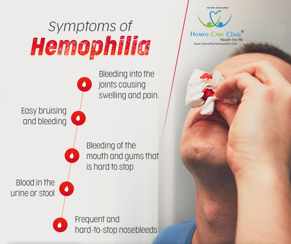 Homeopathic Treatment for Haemophilia