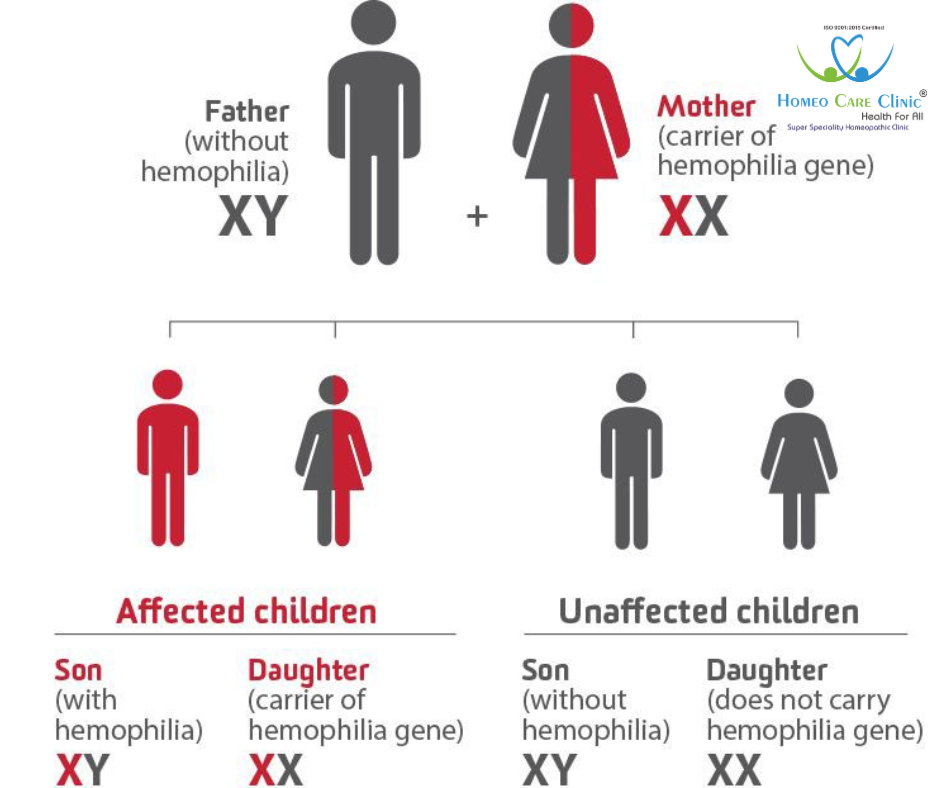 Haemophilia coagulation factor