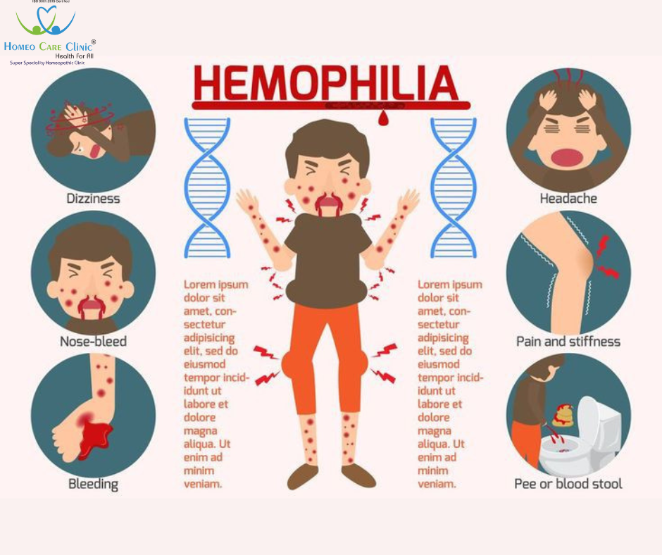 Symptoms of Haemophilia